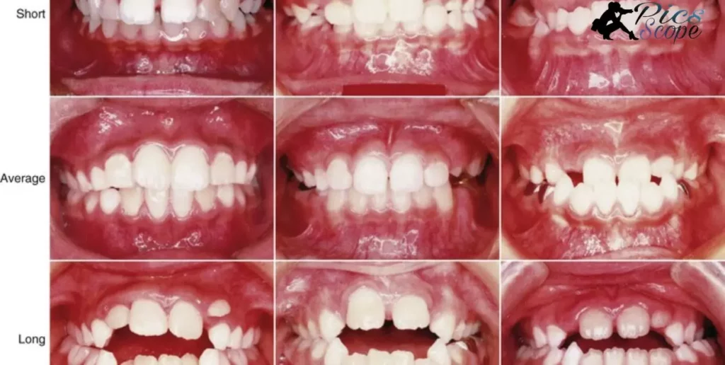 Which photographic view of a patient would show all of the teeth in occlusion?
